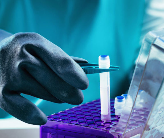 Biobanking. Technician preparing biological sample for deep freezing